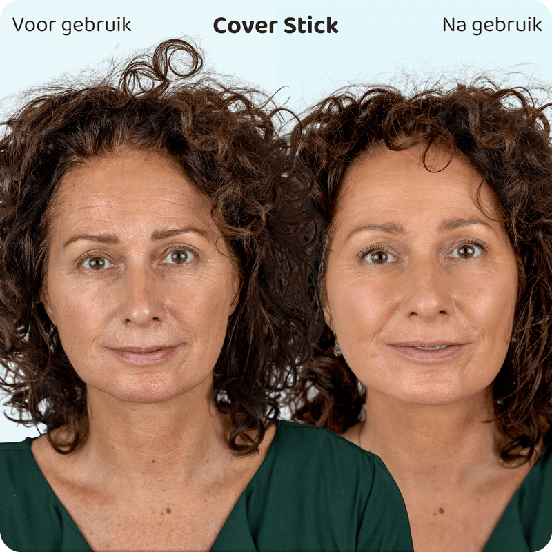 Rosalyne SkinMatch Cover Stick - Lancering